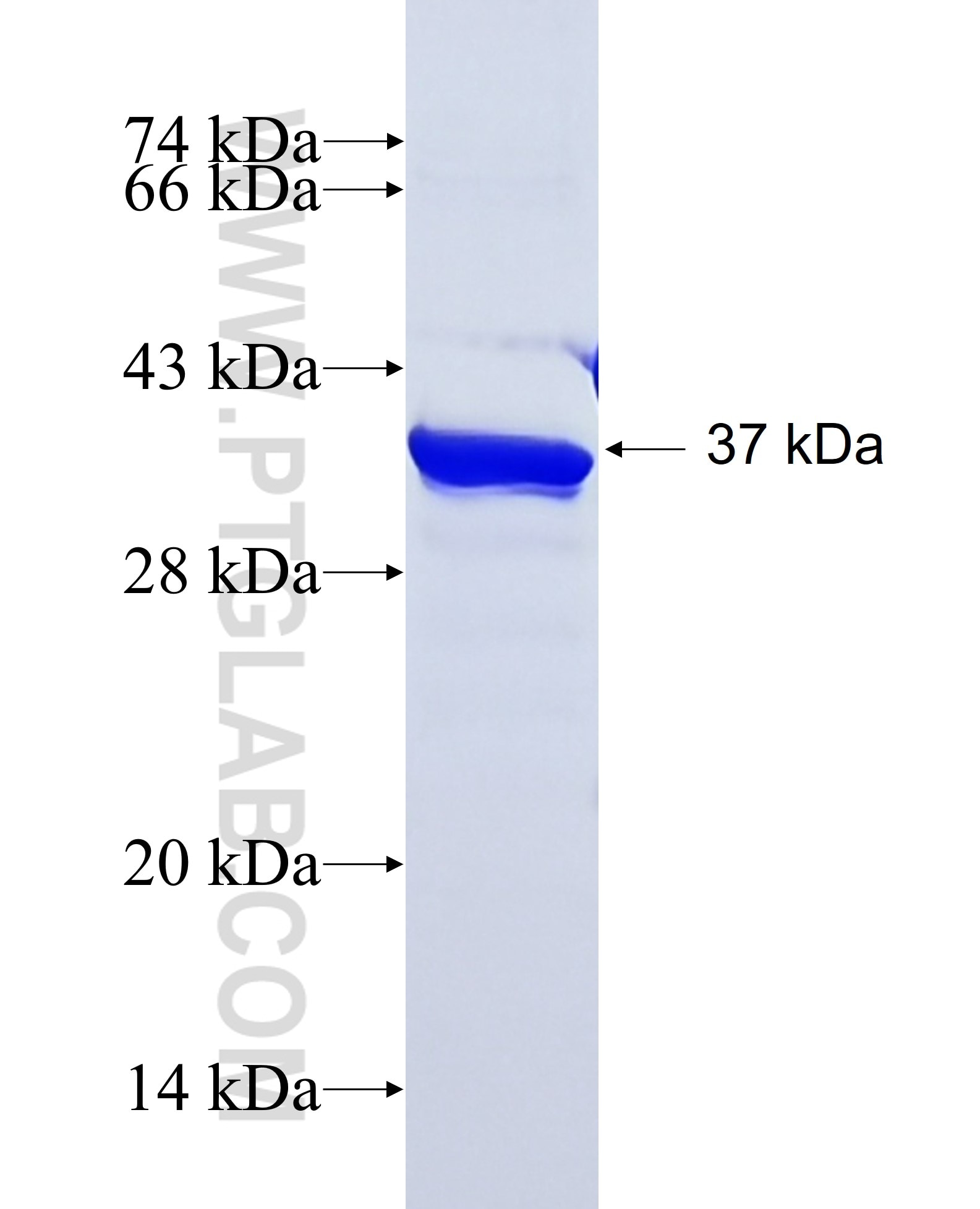 MECP2 fusion protein Ag29632 SDS-PAGE