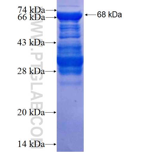 MECP2 fusion protein Ag1309 SDS-PAGE