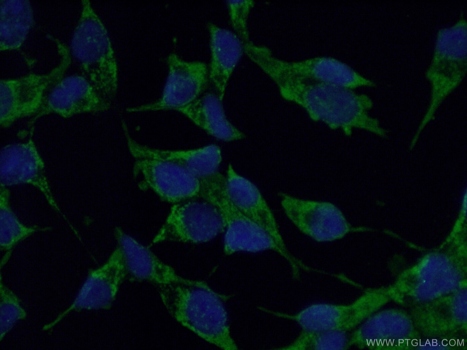 Immunofluorescence (IF) / fluorescent staining of LNCaP cells using MECR Polyclonal antibody (14932-1-AP)