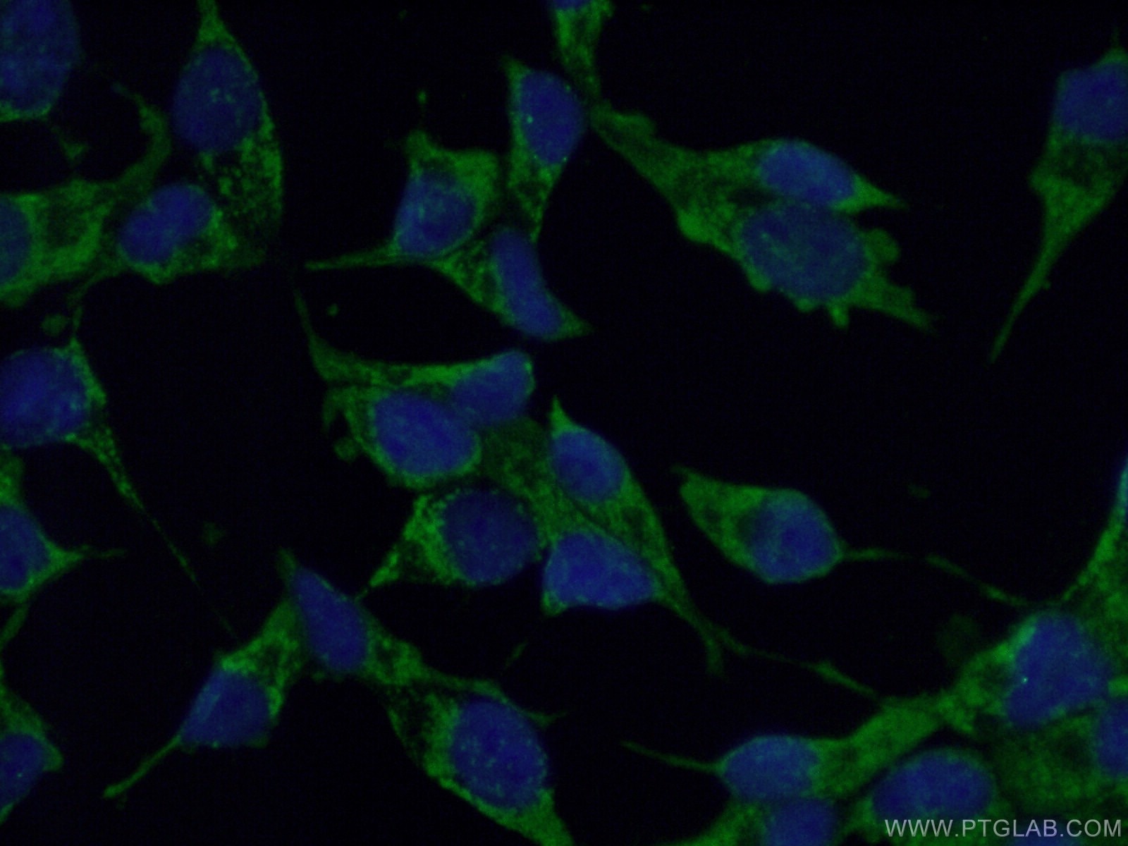 IF Staining of LNCaP using 14932-1-AP