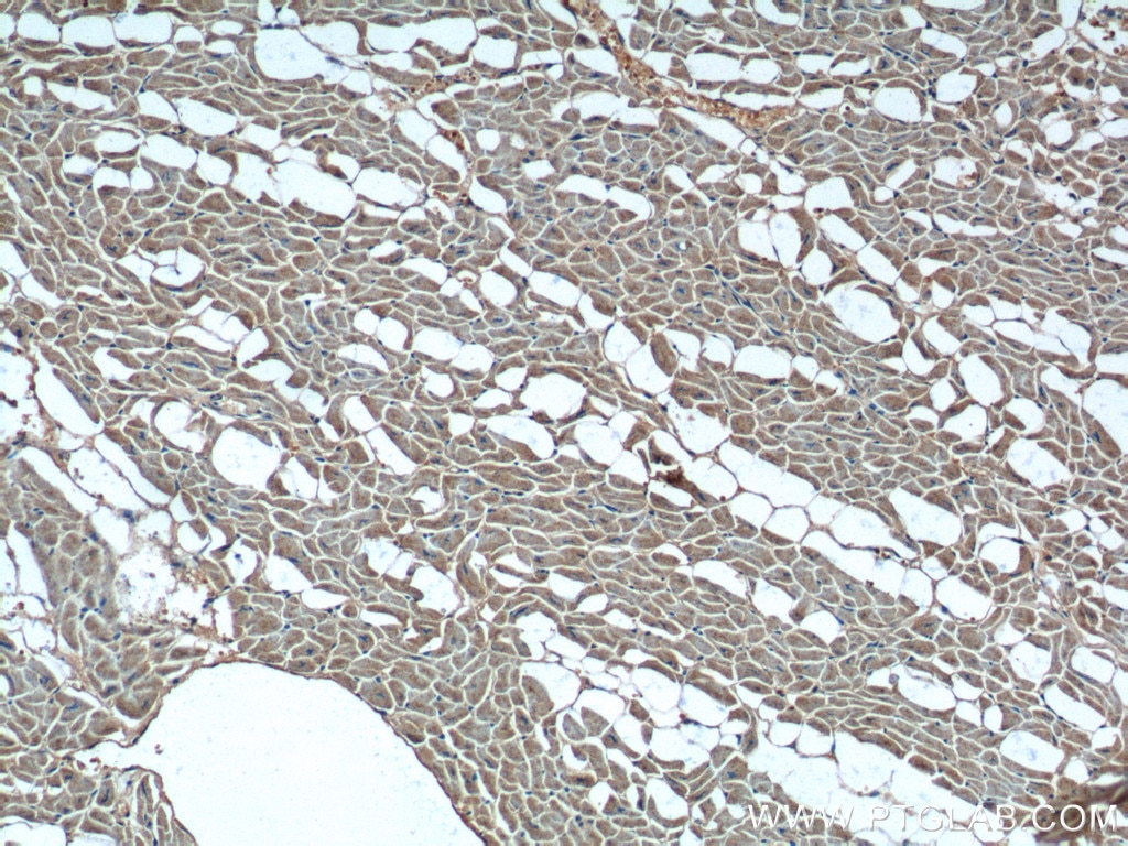 Immunohistochemistry (IHC) staining of human heart tissue using MECR Polyclonal antibody (14932-1-AP)