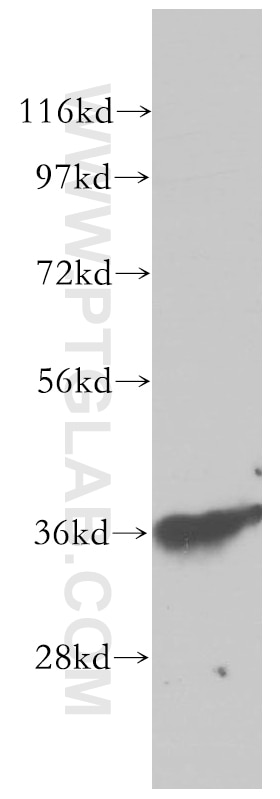 Western Blot (WB) analysis of human stomach tissue using MECR Polyclonal antibody (14932-1-AP)