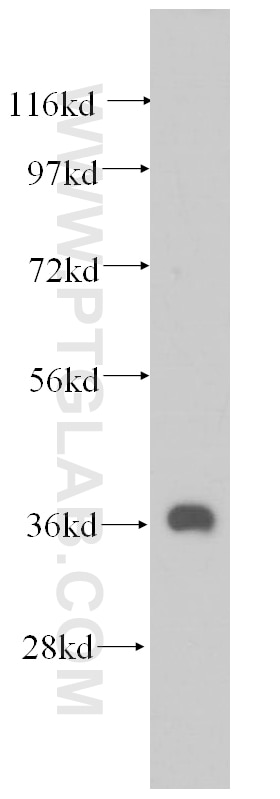 Western Blot (WB) analysis of mouse heart tissue using MECR Polyclonal antibody (14932-1-AP)