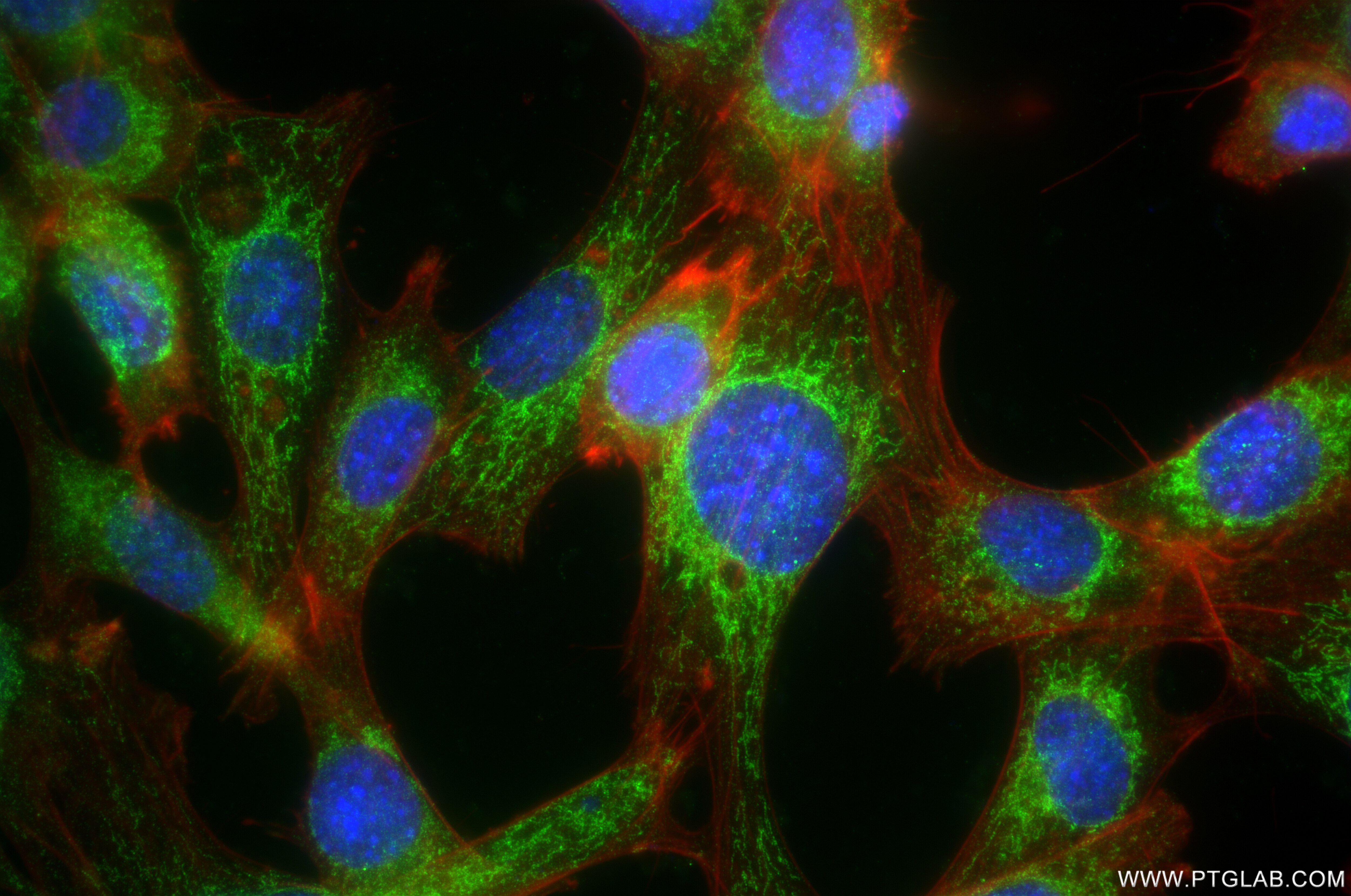 Immunofluorescence (IF) / fluorescent staining of NIH/3T3 cells using MECR Recombinant antibody (84729-4-RR)