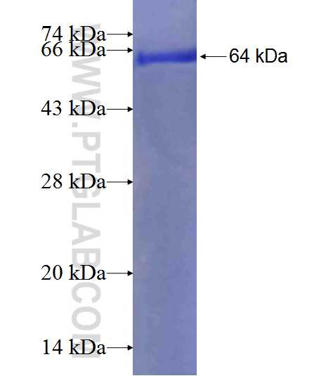 MECR fusion protein Ag6738 SDS-PAGE