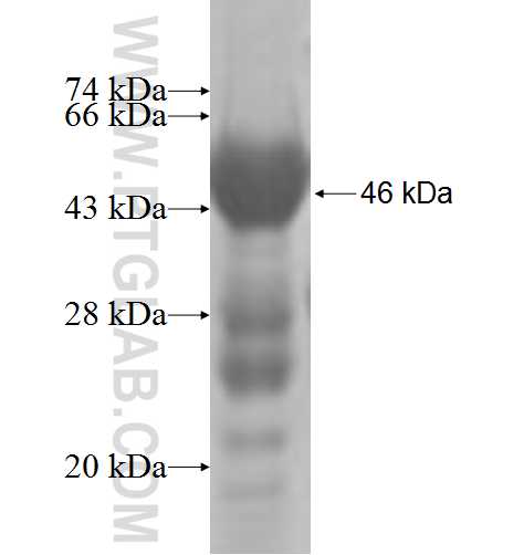 MECR fusion protein Ag6743 SDS-PAGE