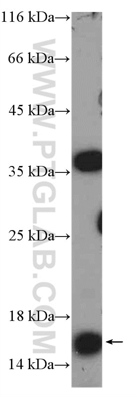 Western Blot (WB) analysis of COLO 320 cells using MED10 Polyclonal antibody (15196-1-AP)