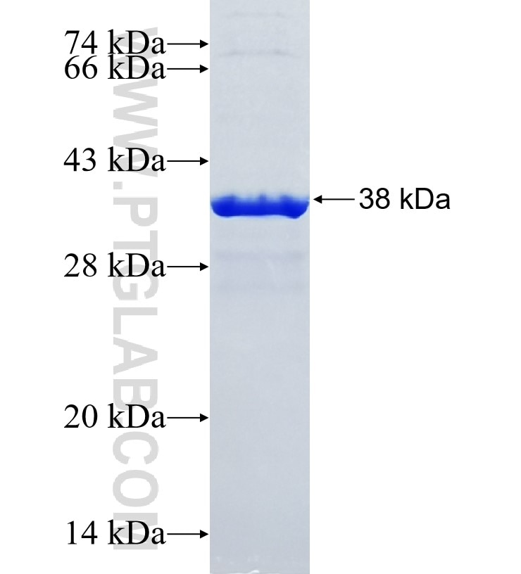 MED11 fusion protein Ag35310 SDS-PAGE