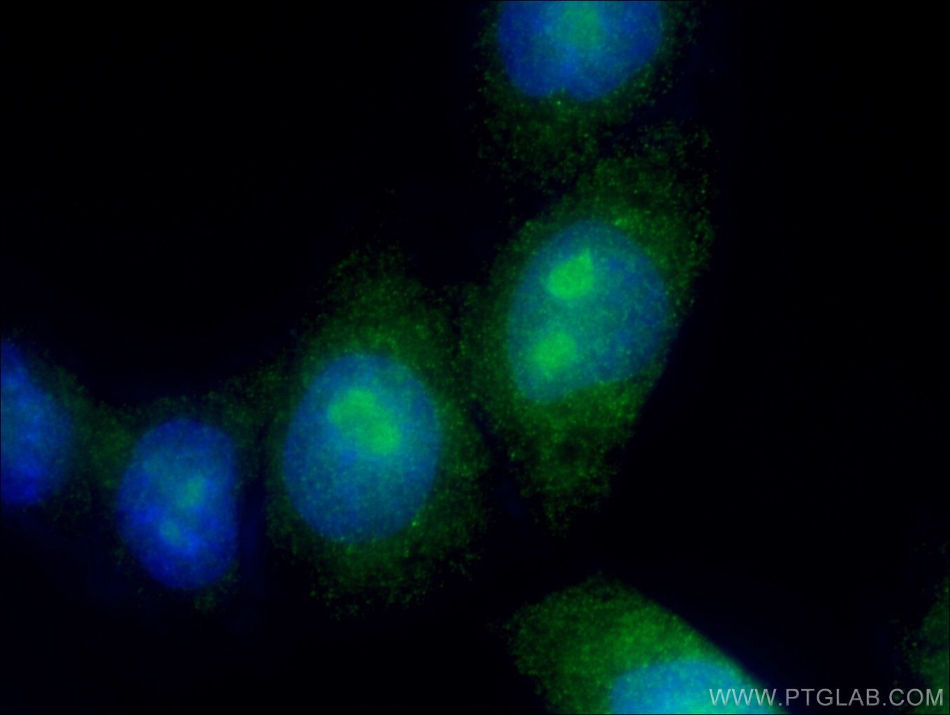 Immunofluorescence (IF) / fluorescent staining of HepG2 cells using MED12 Polyclonal antibody (20028-1-AP)