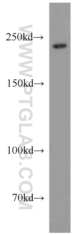 Western Blot (WB) analysis of mouse liver tissue using MED12 Polyclonal antibody (20028-1-AP)