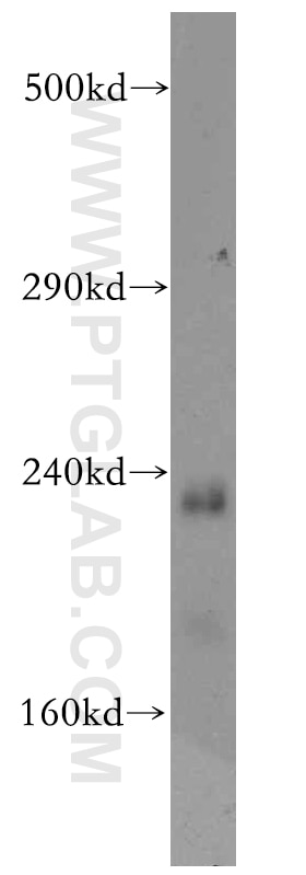 Western Blot (WB) analysis of mouse liver tissue using MED12 Polyclonal antibody (20028-1-AP)