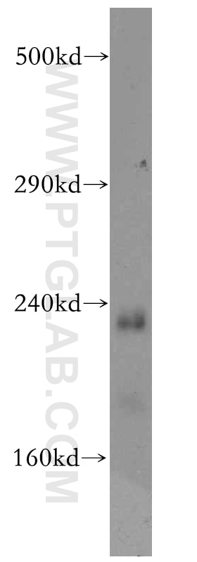 WB analysis of mouse liver using 20028-1-AP