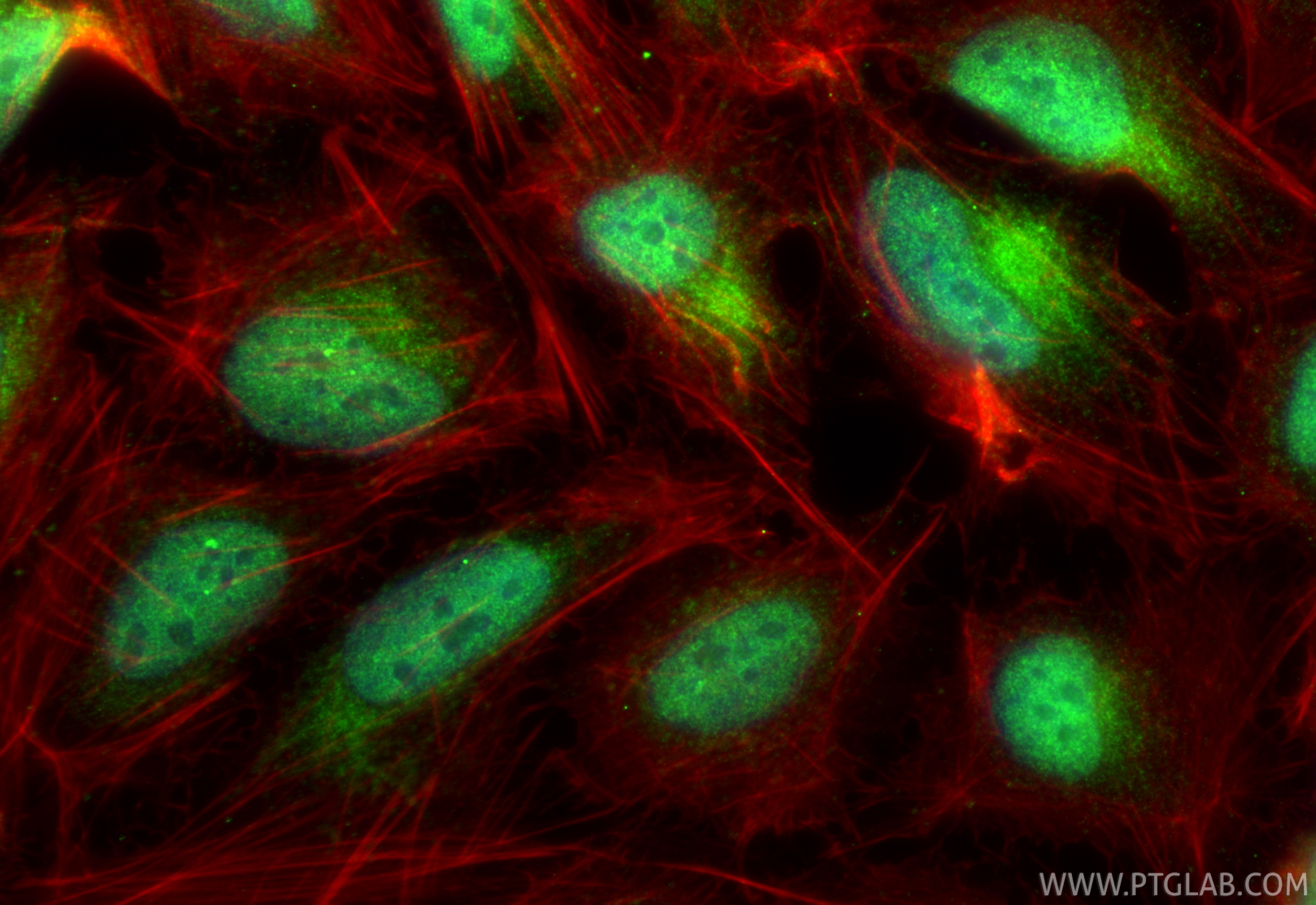 Immunofluorescence (IF) / fluorescent staining of U2OS cells using MED12L Polyclonal antibody (20047-1-AP)