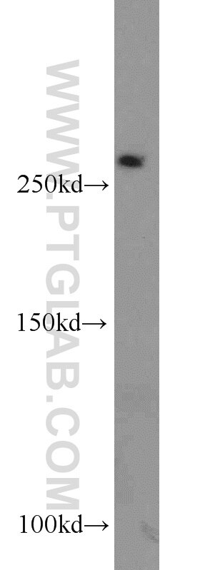 Western Blot (WB) analysis of mouse liver tissue using MED12L Polyclonal antibody (20047-1-AP)