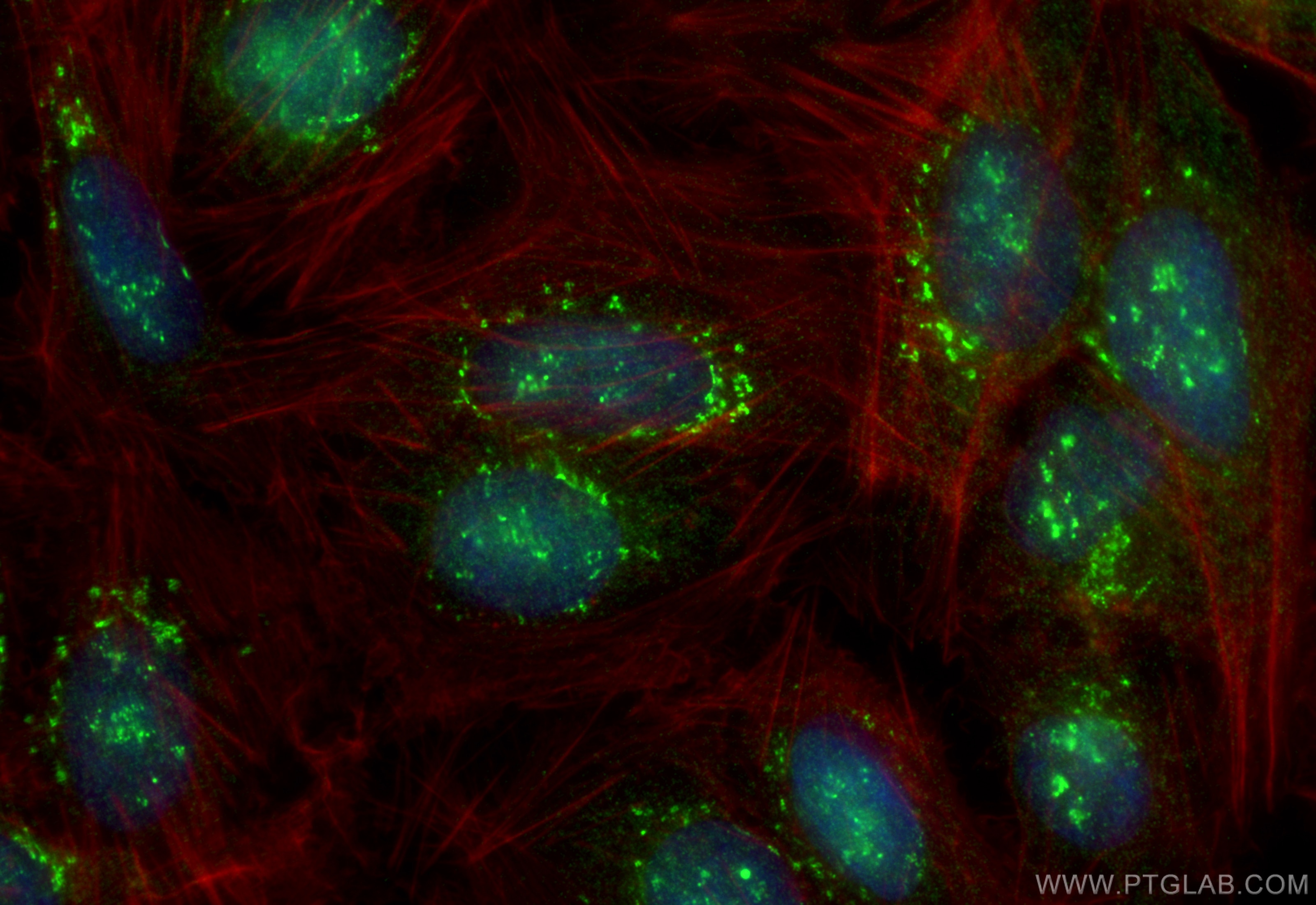 Immunofluorescence (IF) / fluorescent staining of U2OS cells using MED12L Polyclonal antibody (31041-1-AP)