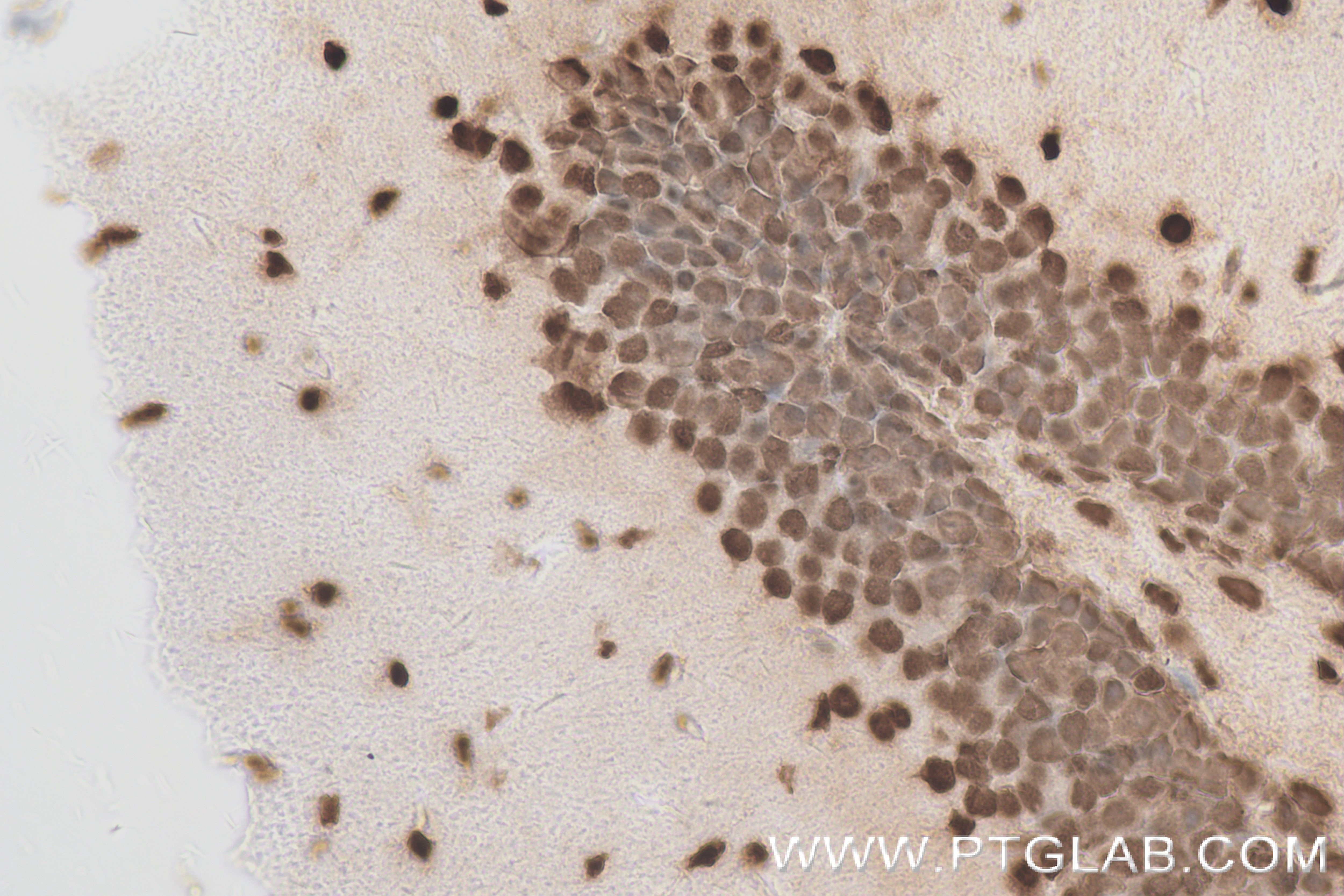 Immunohistochemistry (IHC) staining of mouse brain tissue using MED12L Recombinant antibody (83540-1-RR)