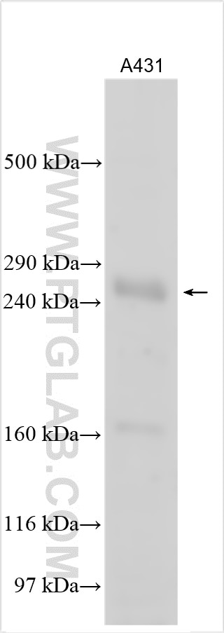 Western Blot (WB) analysis of various lysates using MED13-Specific Polyclonal antibody (20029-1-AP)