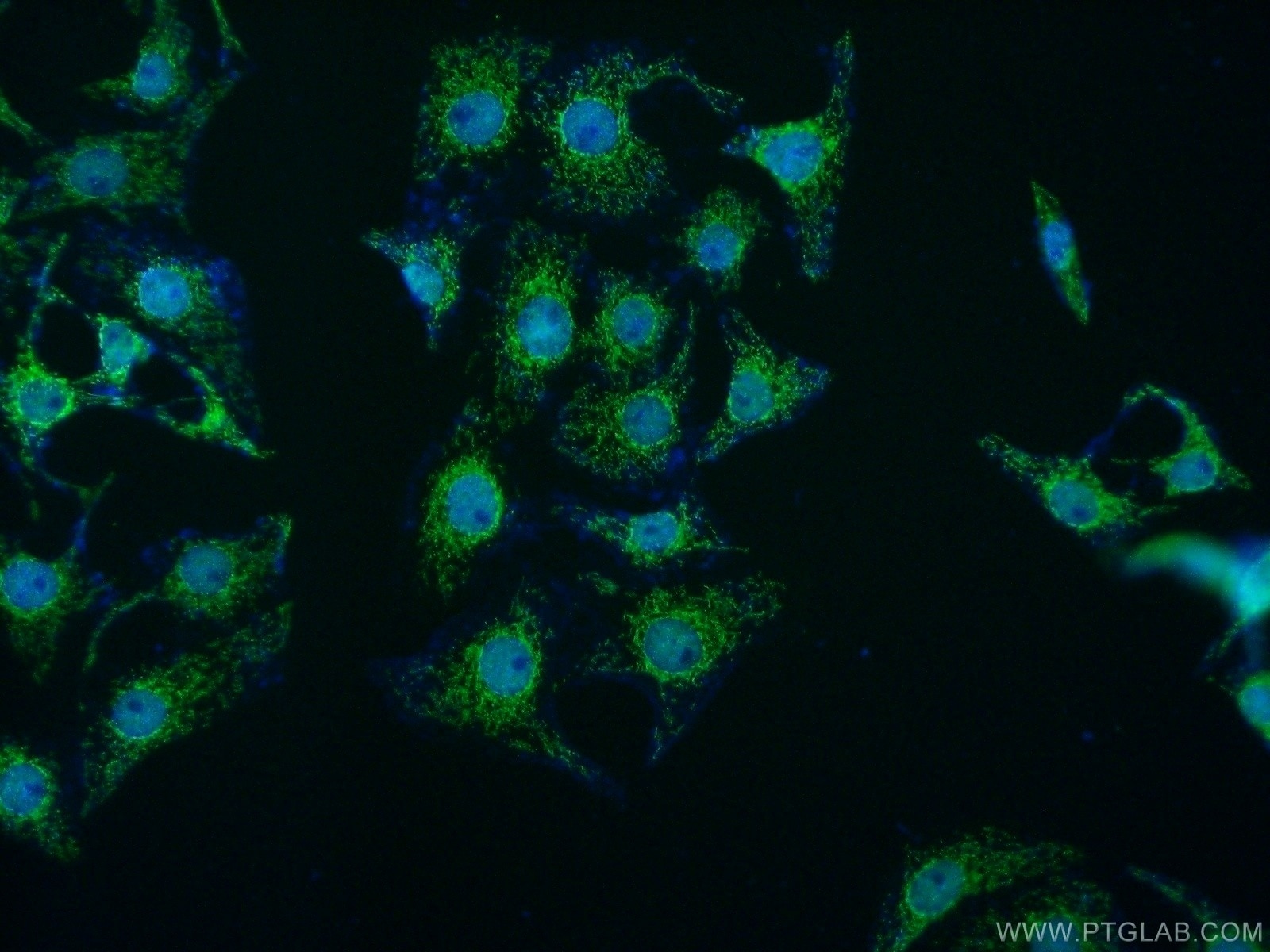 Immunofluorescence (IF) / fluorescent staining of SH-SY5Y cells using MED15 Polyclonal antibody (11566-1-AP)