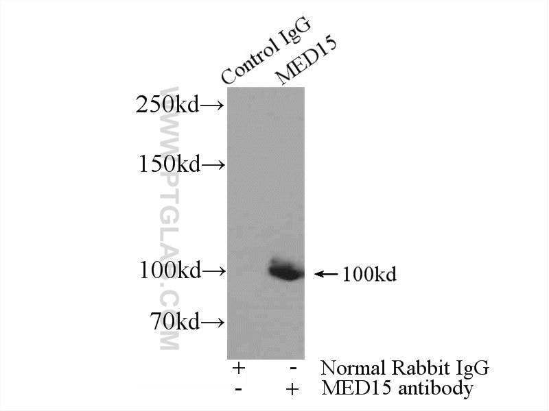 Immunoprecipitation (IP) experiment of K-562 cells using MED15 Polyclonal antibody (11566-1-AP)