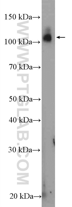 Western Blot (WB) analysis of SMMC-7721 cells using MED15 Polyclonal antibody (11566-1-AP)