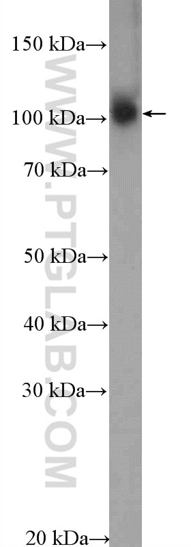 Western Blot (WB) analysis of HuH-7  cells using MED15 Polyclonal antibody (11566-1-AP)