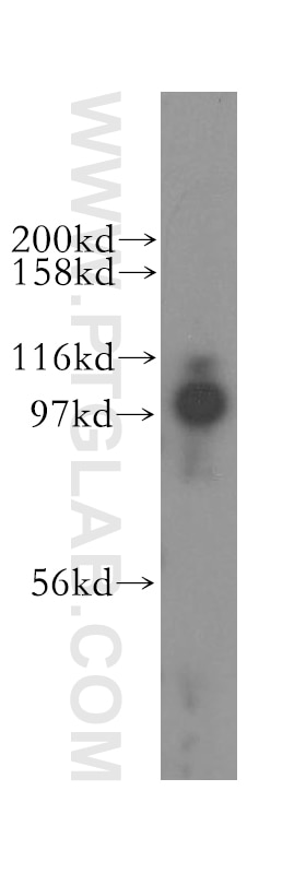 Western Blot (WB) analysis of K-562 cells using MED15 Polyclonal antibody (11566-1-AP)