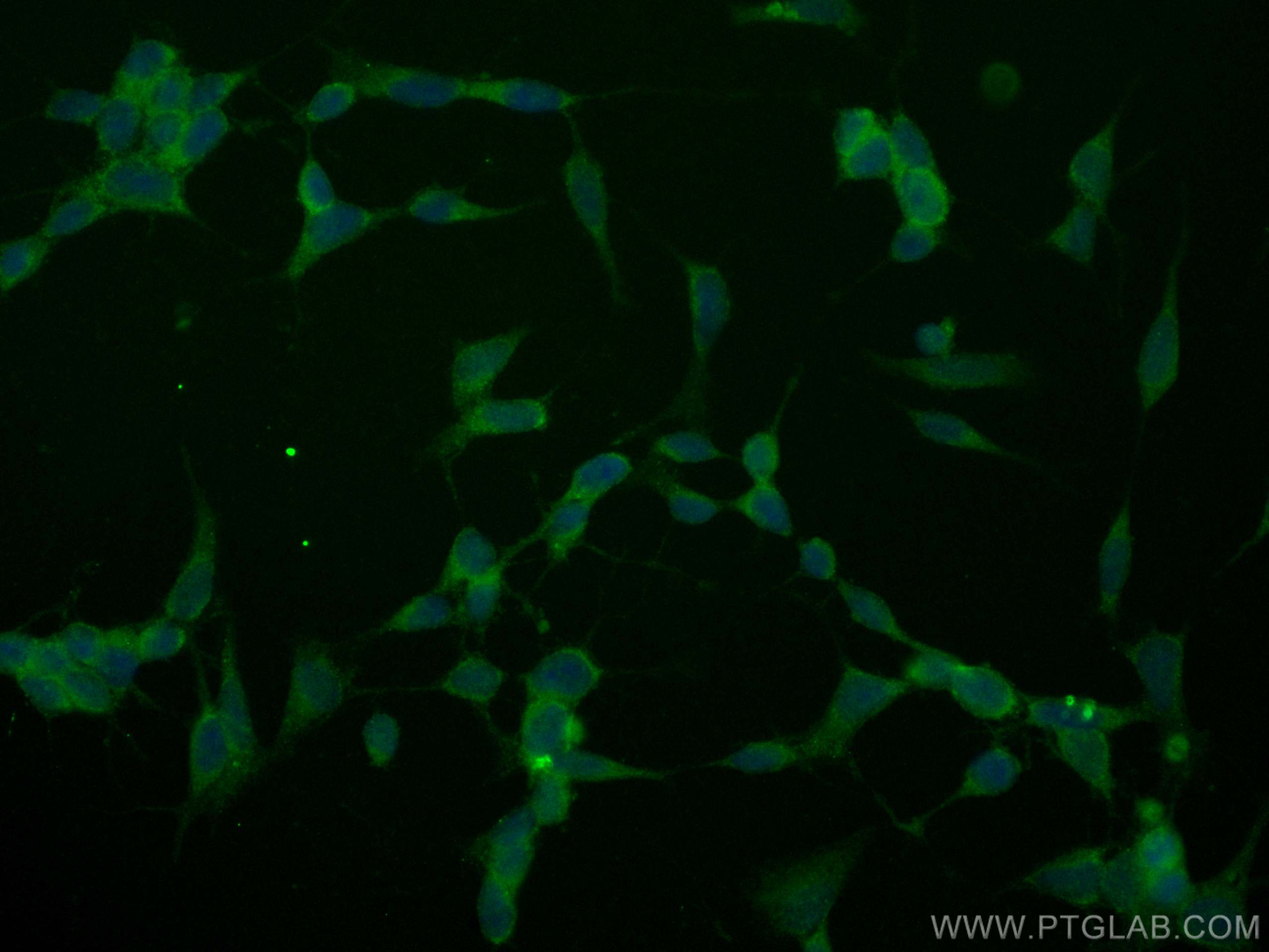 Immunofluorescence (IF) / fluorescent staining of SH-SY5Y cells using CoraLite® Plus 488-conjugated MED15 Polyclonal ant (CL488-11566)
