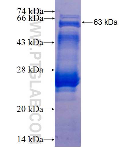 MED15 fusion protein Ag2143 SDS-PAGE