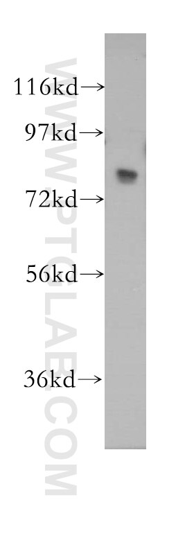 Western Blot (WB) analysis of human liver tissue using MED17 Polyclonal antibody (11505-1-AP)