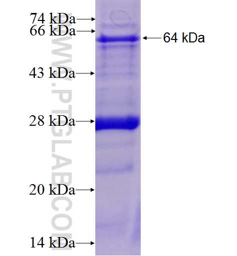 MED17 fusion protein Ag2057 SDS-PAGE
