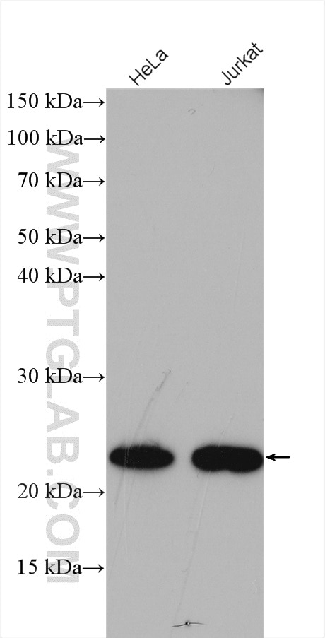 Western Blot (WB) analysis of various lysates using MED18 Polyclonal antibody (15352-1-AP)