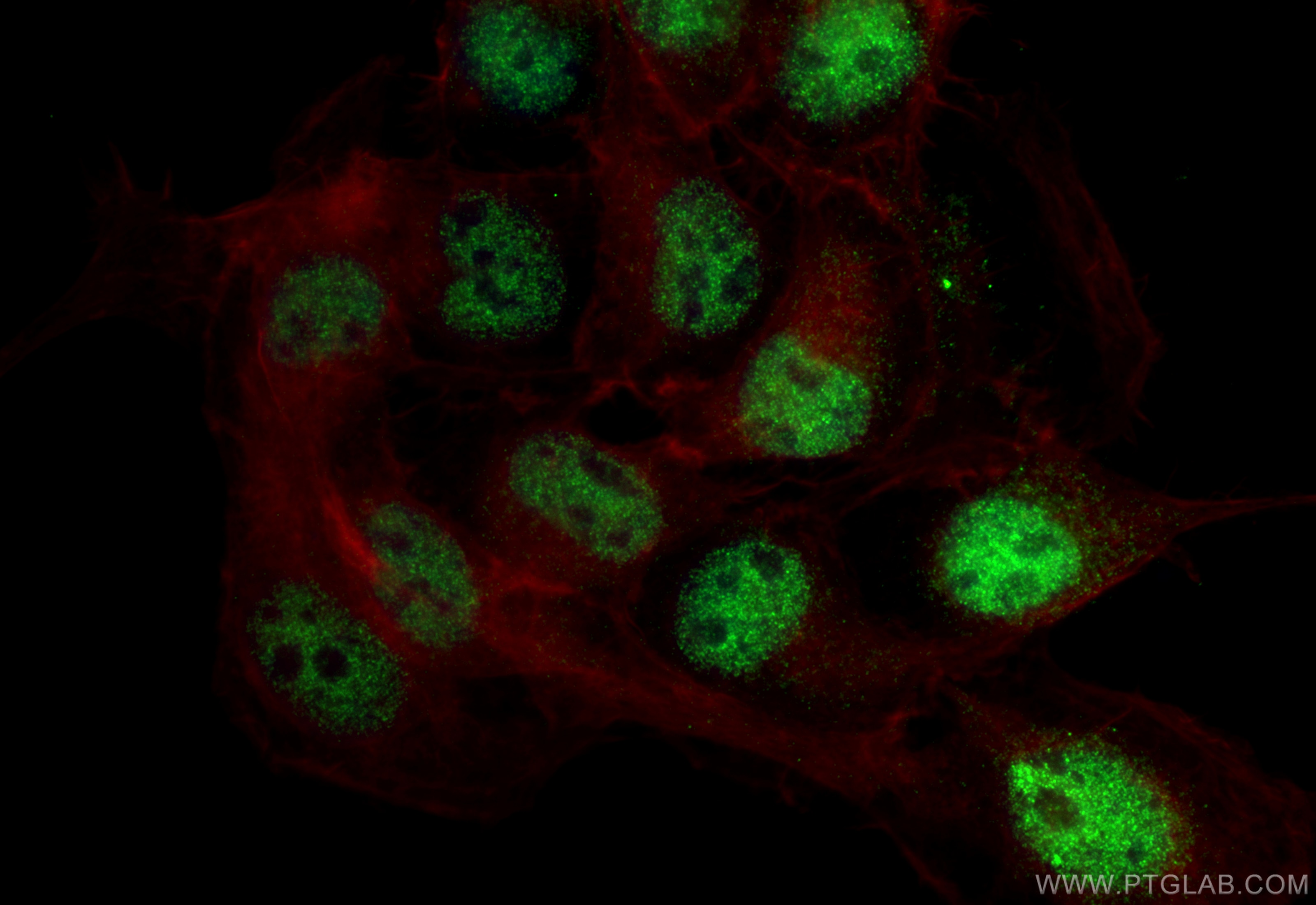 Immunofluorescence (IF) / fluorescent staining of A431 cells using MED18 Monoclonal antibody (60467-1-Ig)