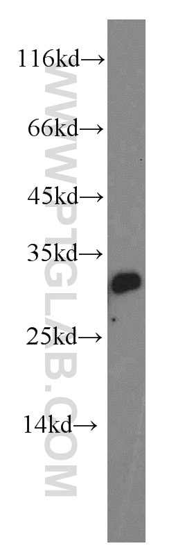 Western Blot (WB) analysis of human testis tissue using MED19 Polyclonal antibody (13418-1-AP)