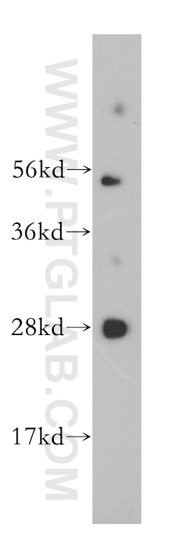 Western Blot (WB) analysis of HeLa cells using MED20 Polyclonal antibody (17598-1-AP)