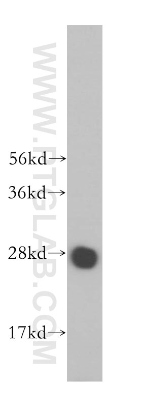 Western Blot (WB) analysis of K-562 cells using MED20 Polyclonal antibody (17598-1-AP)