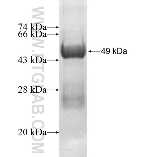 MED20 fusion protein Ag11598 SDS-PAGE