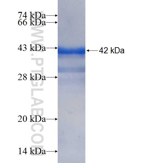 MED21 fusion protein Ag8639 SDS-PAGE