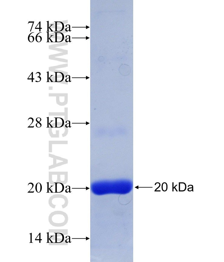 MED22 fusion protein Ag9800 SDS-PAGE