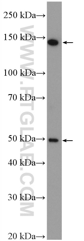 Western Blot (WB) analysis of A375 cells using MED23 Polyclonal antibody (27850-1-AP)