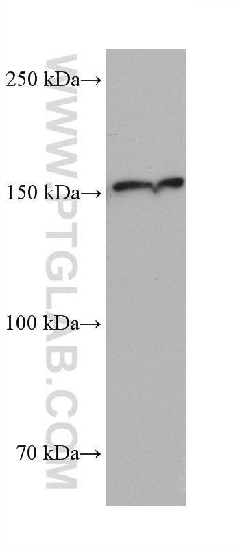 Western Blot (WB) analysis of 4T1 cells using MED23 Monoclonal antibody (68307-1-Ig)