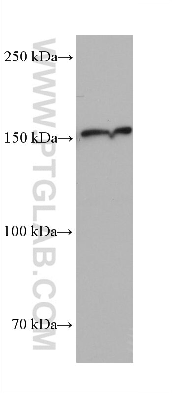 WB analysis of 4T1 using 68307-1-Ig