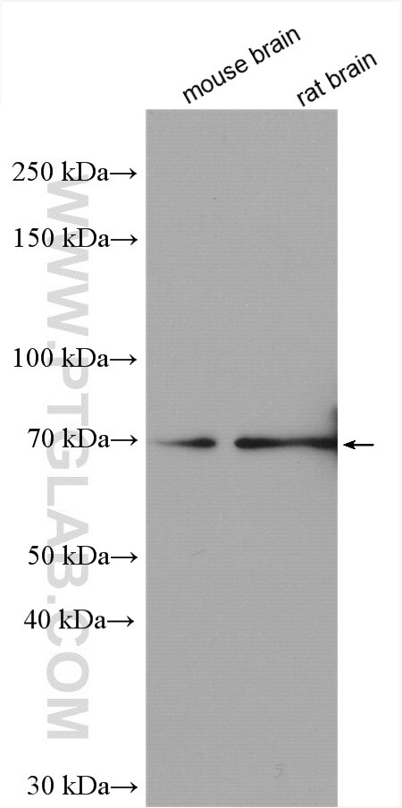 Western Blot (WB) analysis of various lysates using MED26 Polyclonal antibody (21043-1-AP)