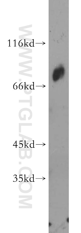 Western Blot (WB) analysis of mouse ovary tissue using MED26 Polyclonal antibody (21043-1-AP)