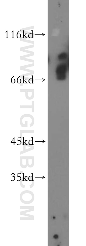 Western Blot (WB) analysis of HEK-293 cells using MED26 Polyclonal antibody (21043-1-AP)