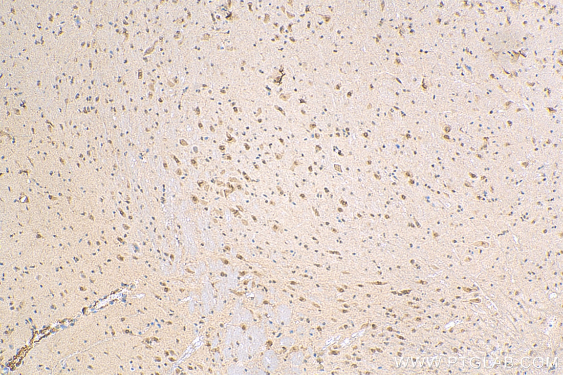 Immunohistochemistry (IHC) staining of mouse brain tissue using MED28 Polyclonal antibody (16262-1-AP)
