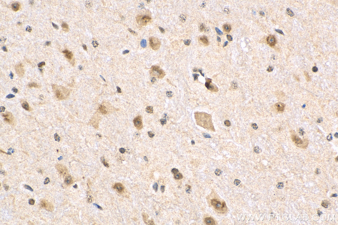 Immunohistochemistry (IHC) staining of mouse brain tissue using MED28 Polyclonal antibody (16262-1-AP)