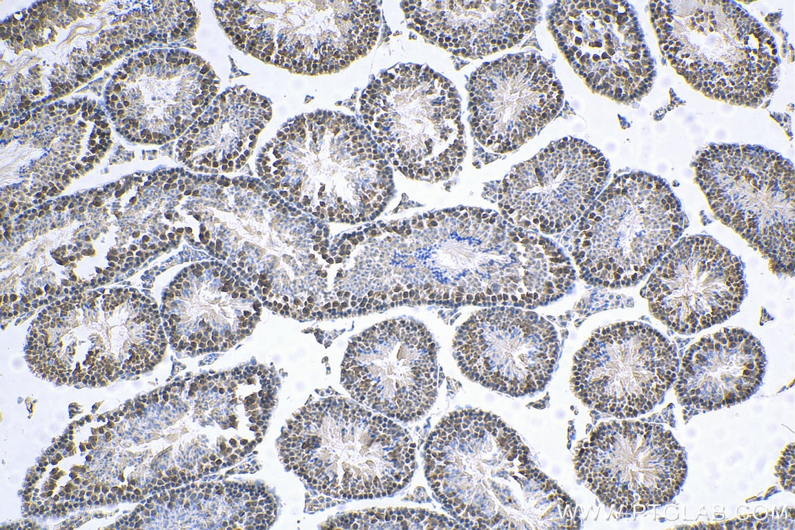 Immunohistochemistry (IHC) staining of mouse testis tissue using MED28 Polyclonal antibody (16262-1-AP)