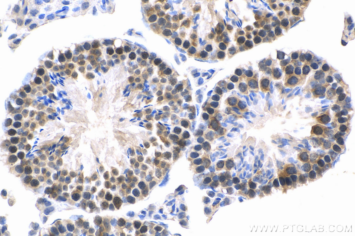 Immunohistochemistry (IHC) staining of mouse testis tissue using MED28 Polyclonal antibody (16262-1-AP)