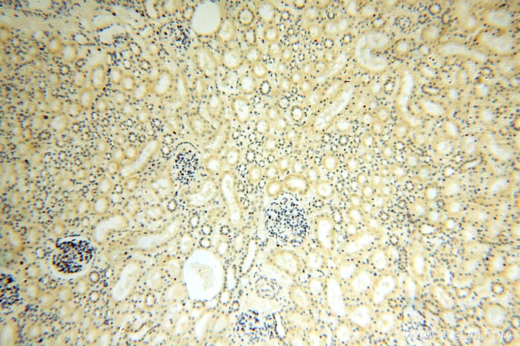 IHC staining of human kidney using 16262-1-AP