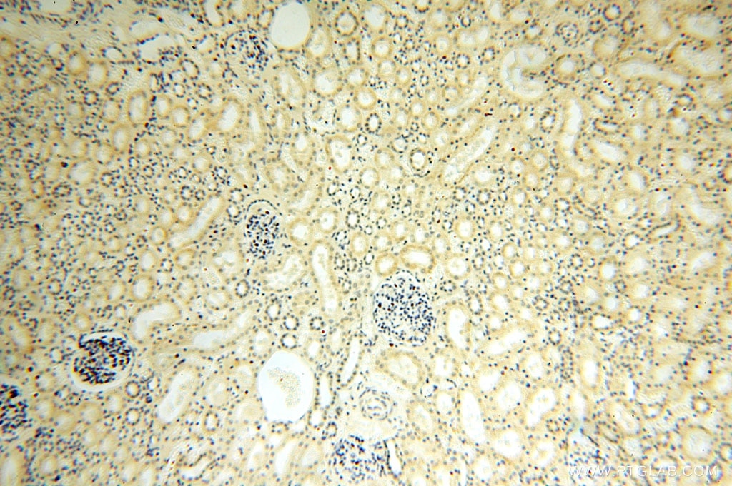 Immunohistochemistry (IHC) staining of human kidney tissue using MED28 Polyclonal antibody (16262-1-AP)